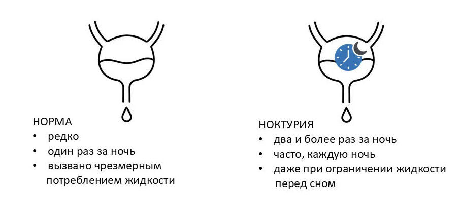 Ночное мочеиспускание: норма и патология